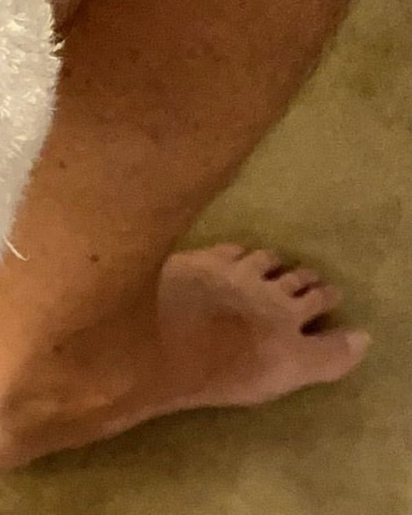 Foot at Rest, by Atelier Thom